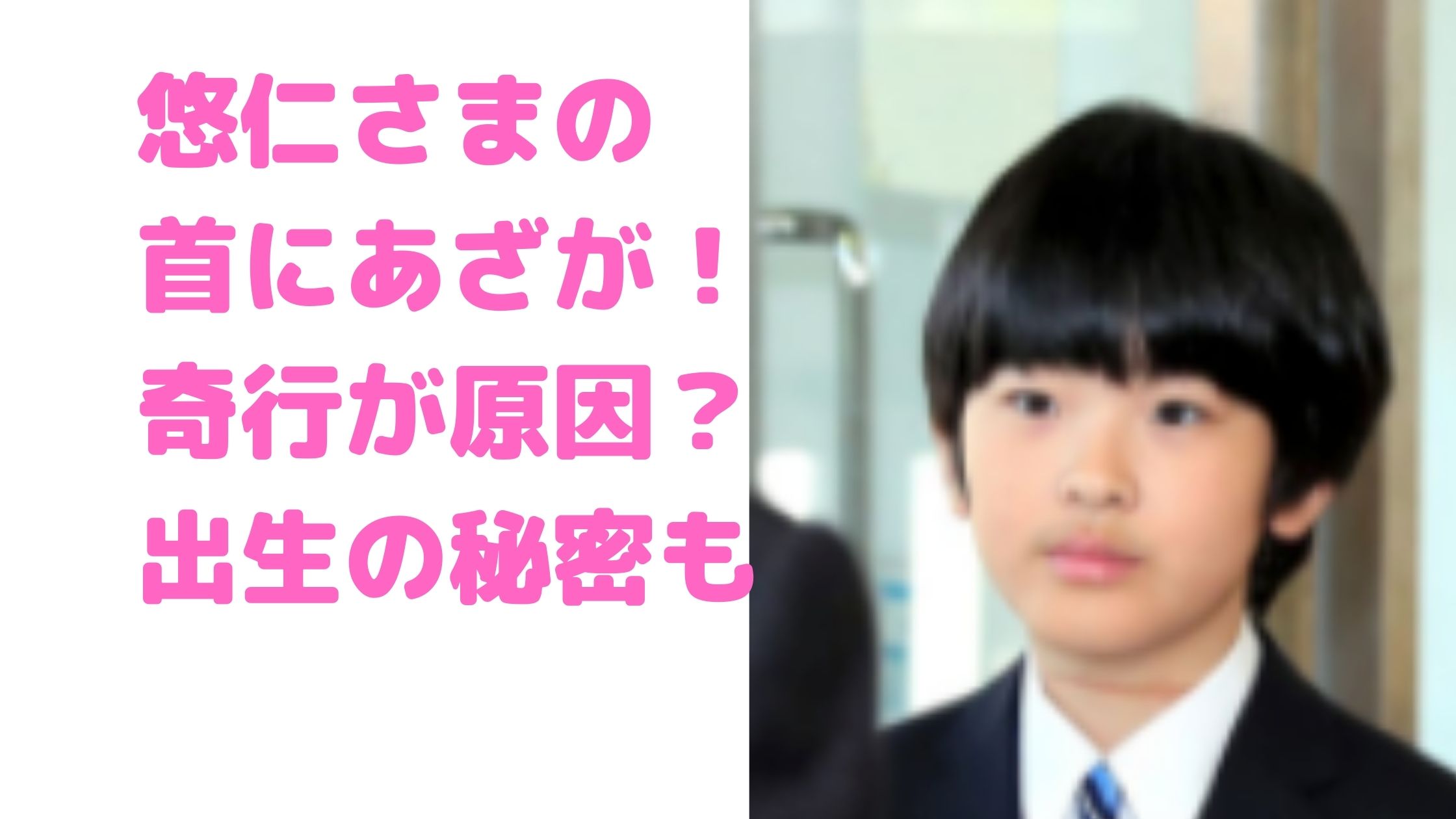 悠仁さま　首のあざ　奇行　出生の秘密　誰の子