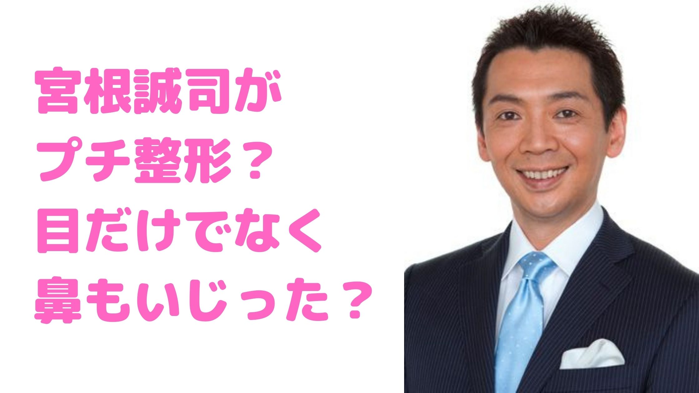 宮根誠司　プチ整形　眼瞼下垂　病院　費用　鼻　顔色