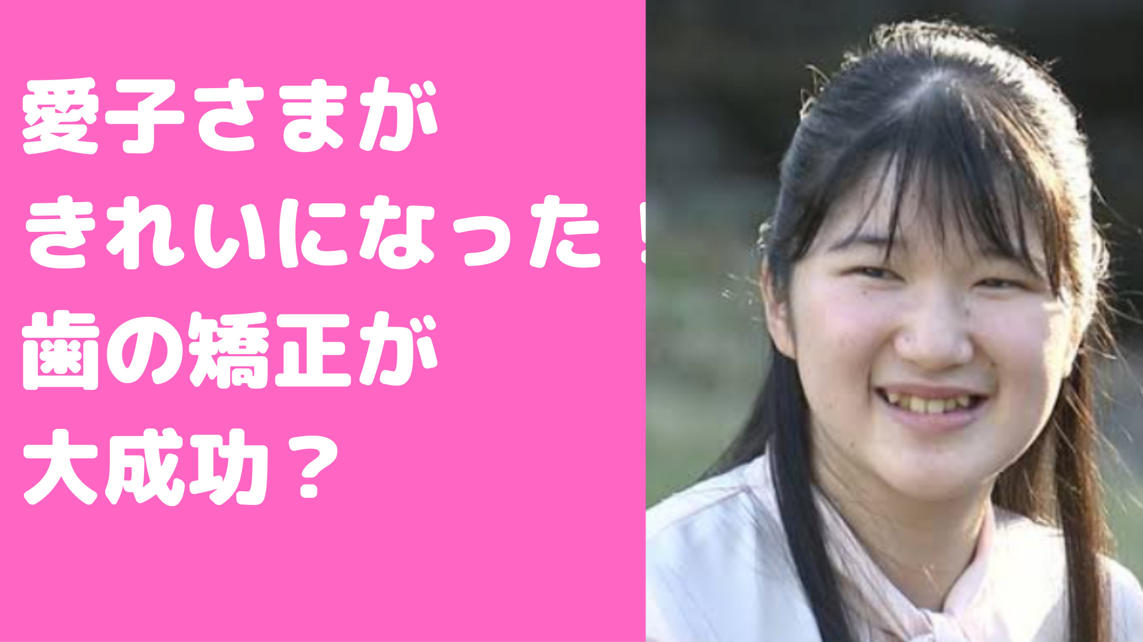 愛子さま　きれいになった　歯の矯正　痩せた　メイク