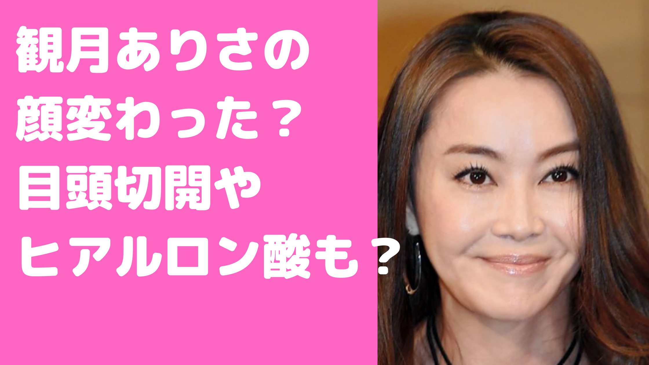 観月ありさ　顔が変わった　整形　怖い　若い頃　老けた　太った　頬　ヒアルロン酸　目頭切開