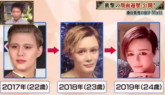 Matt桑田の昔の顔とすっぴん比較!整形外科やオネエ疑惑、母親や父親、兄の顔画像も! - M-media