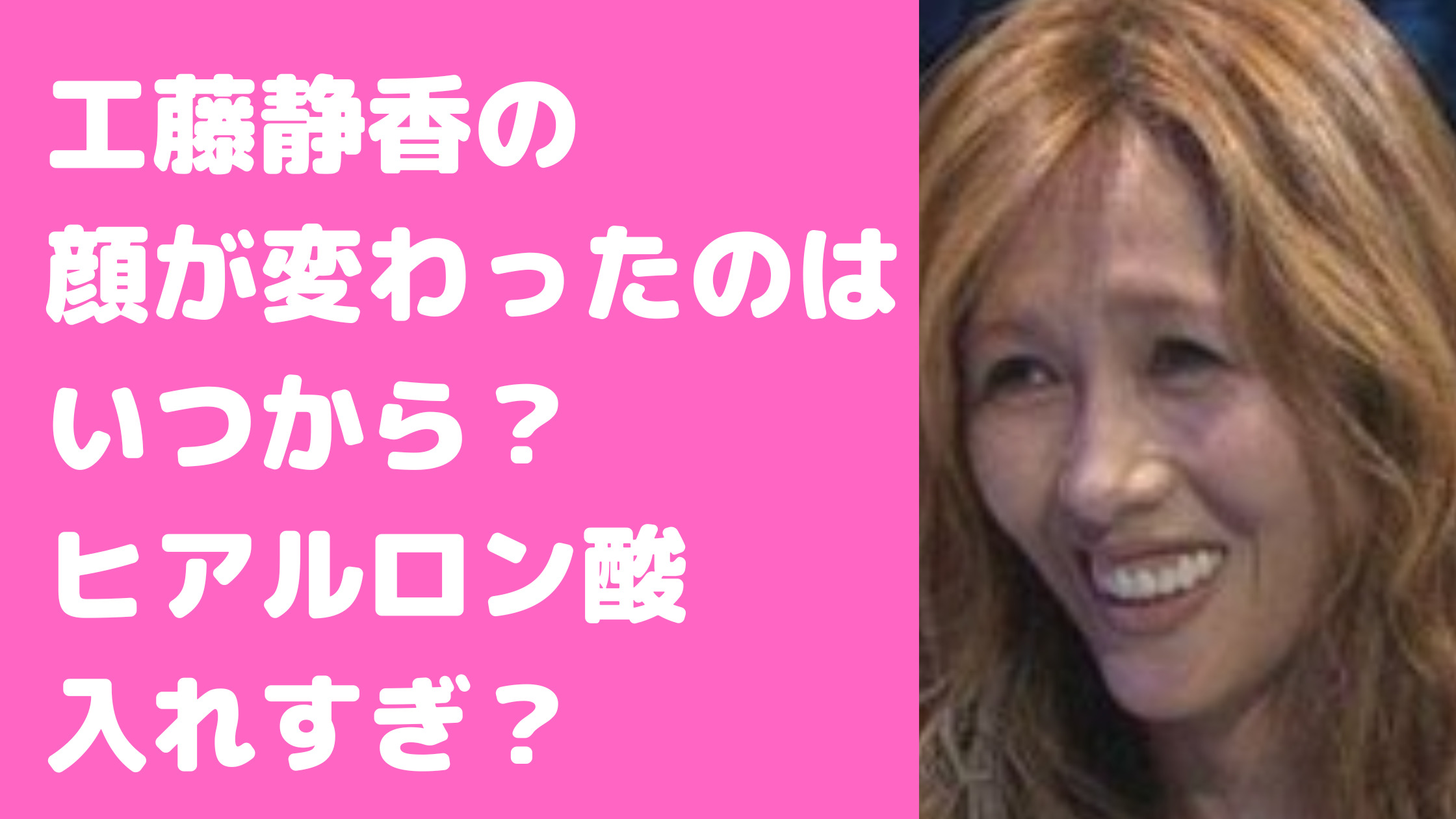 工藤静香　顔変わりすぎ　変わった　若い頃　劣化　いつから　顔長い　顔歪み　顔でかい　鼻いじった　ほうれい線　