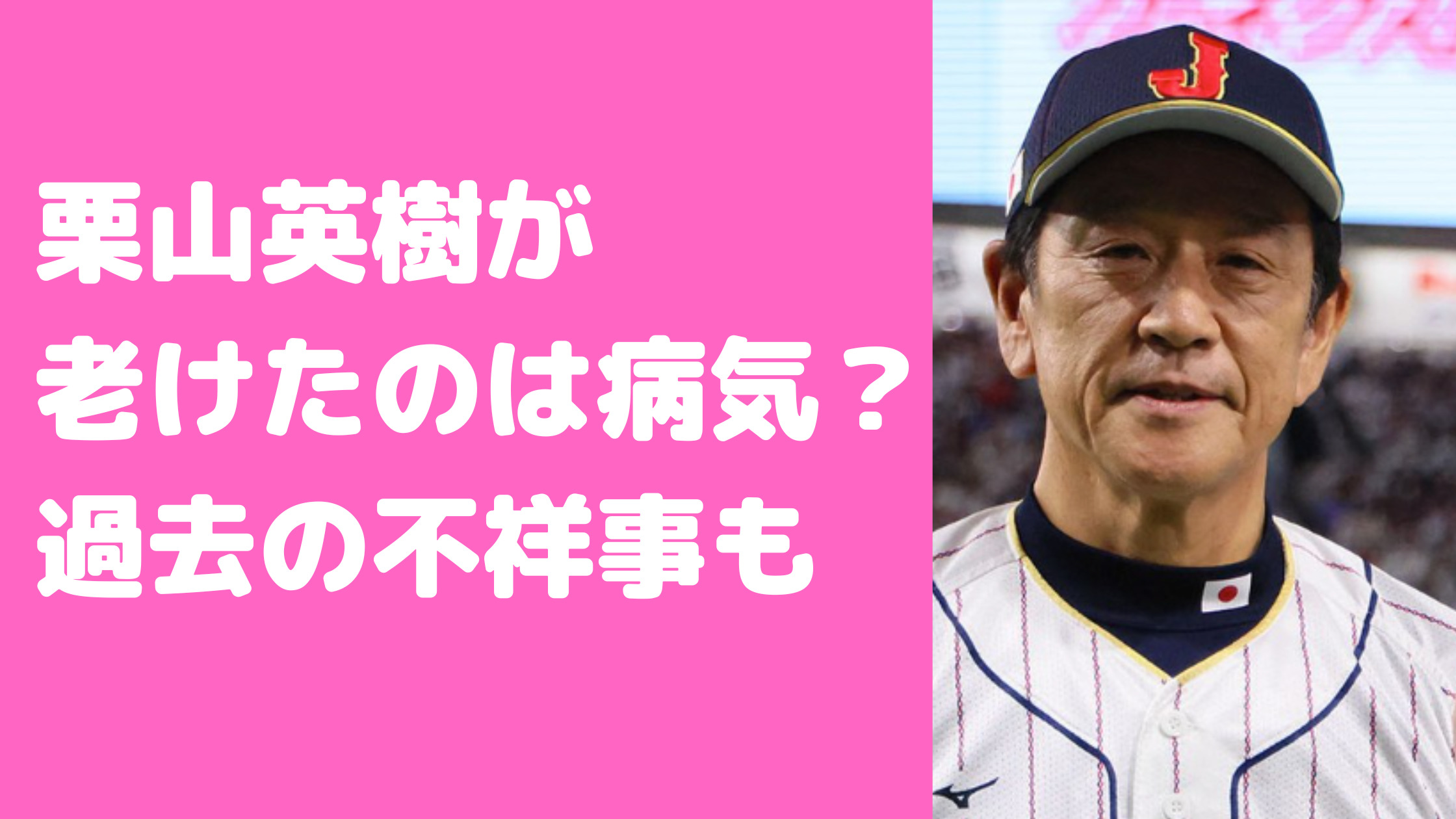 栗山英樹　老けた　病気　不祥事