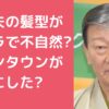 橋幸夫　髪型　カツラ　いつから 橋幸夫　髪型　カツラ