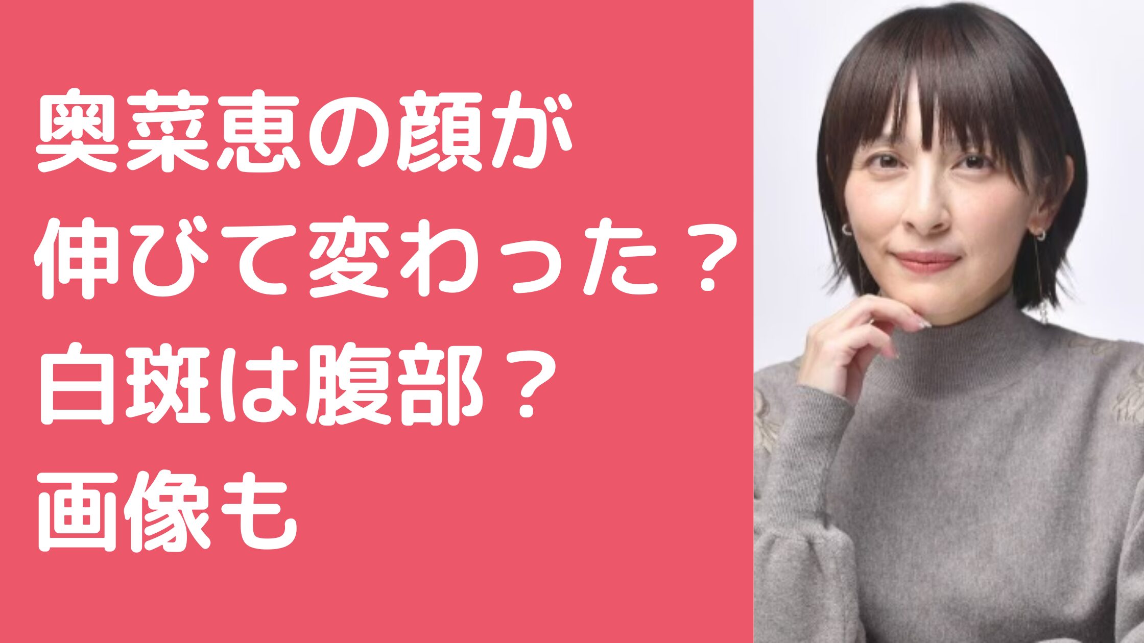 奥菜恵　顔が伸びた　顔長い　顔変わった　整形　劣化　白斑　どこ