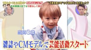 ウエンツ瑛士　髪増えた　子供時代　ハゲ