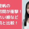 吉岡里帆　目頭切開　怖い　ほうれい線　整形前　変　