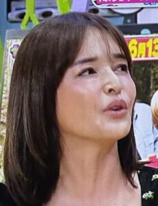梨花　顔変わった　ヒアルロン酸