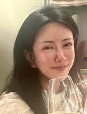 中野信子　顔変わった　整形失敗　整形しすぎ　ほっぺたボコボコ